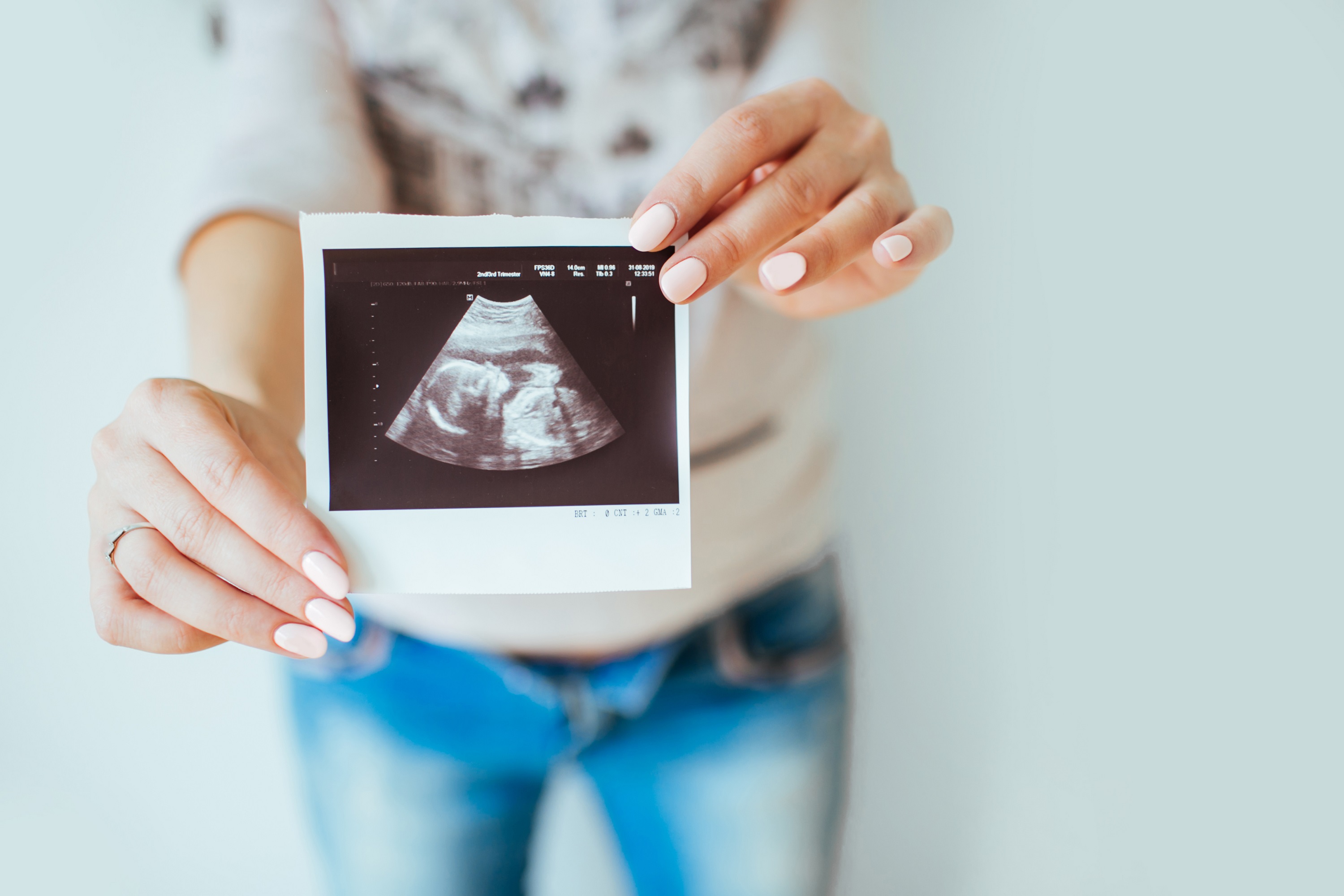 Imagem: em destaque na imagem, mãos femininas segurando foto de ultrassom de bebê.