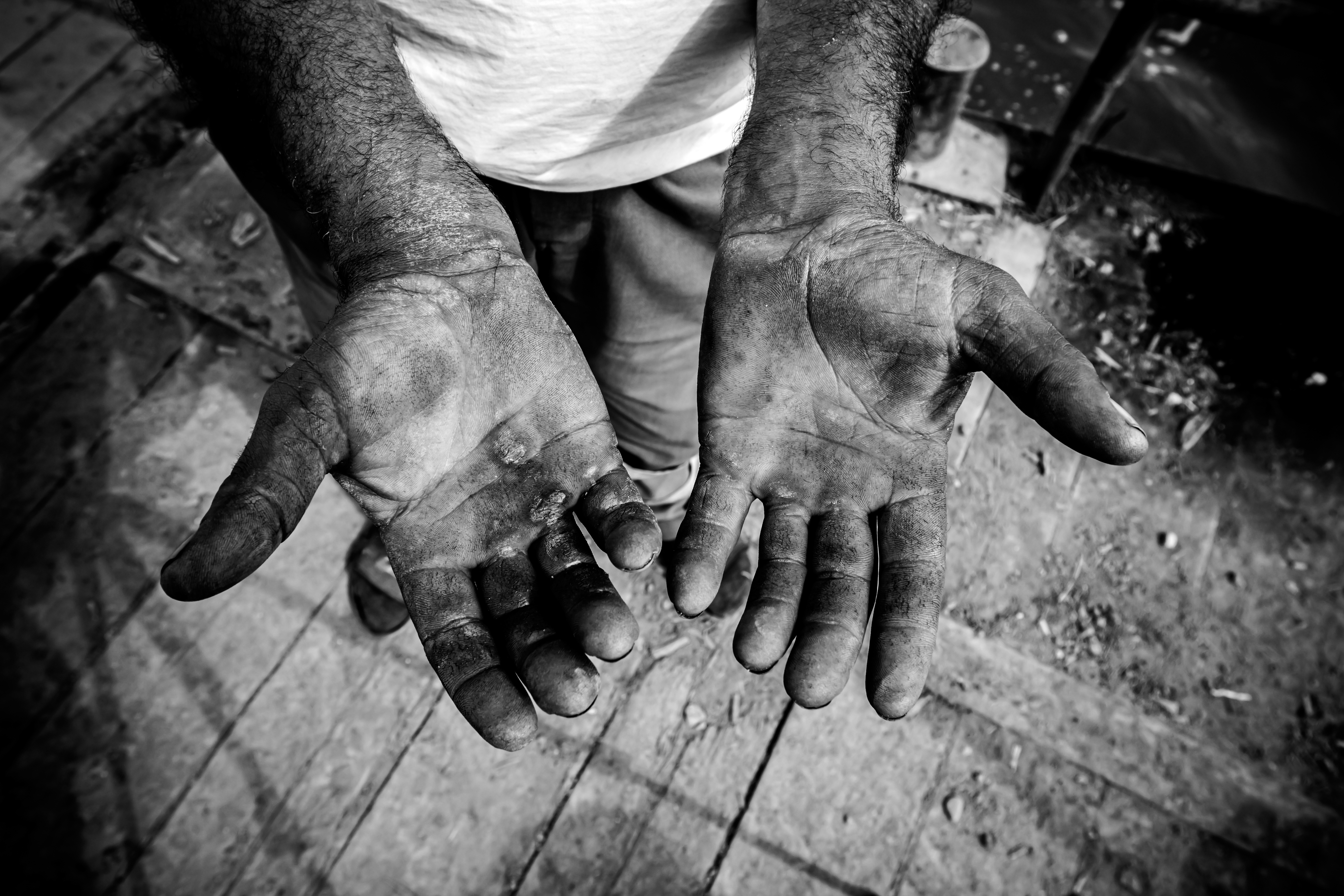 Imagem: mãos de homem, machucadas